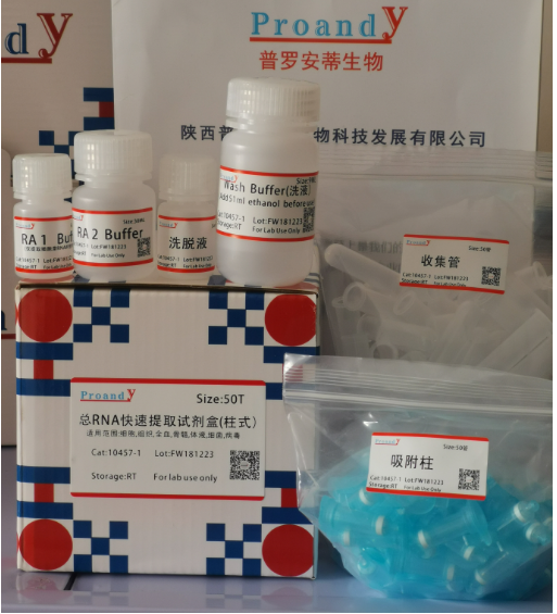 1704788882637016.png 總RNA提取試劑盒(柱式)-1.png